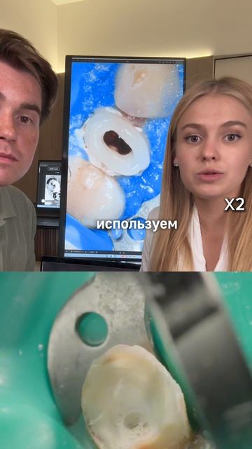 IMG_2437как спасти разрушенный зуб, даже если все приговорили его к удалению.