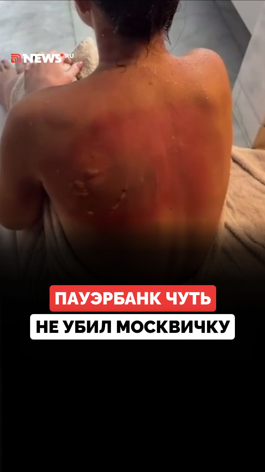 Пауэрбанк едва не сжег квартиру блогера Анны Отавиной: девушка получила ожог второй степени
