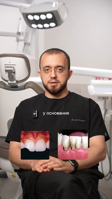 Что произойдет, если у Вас кривые зубы