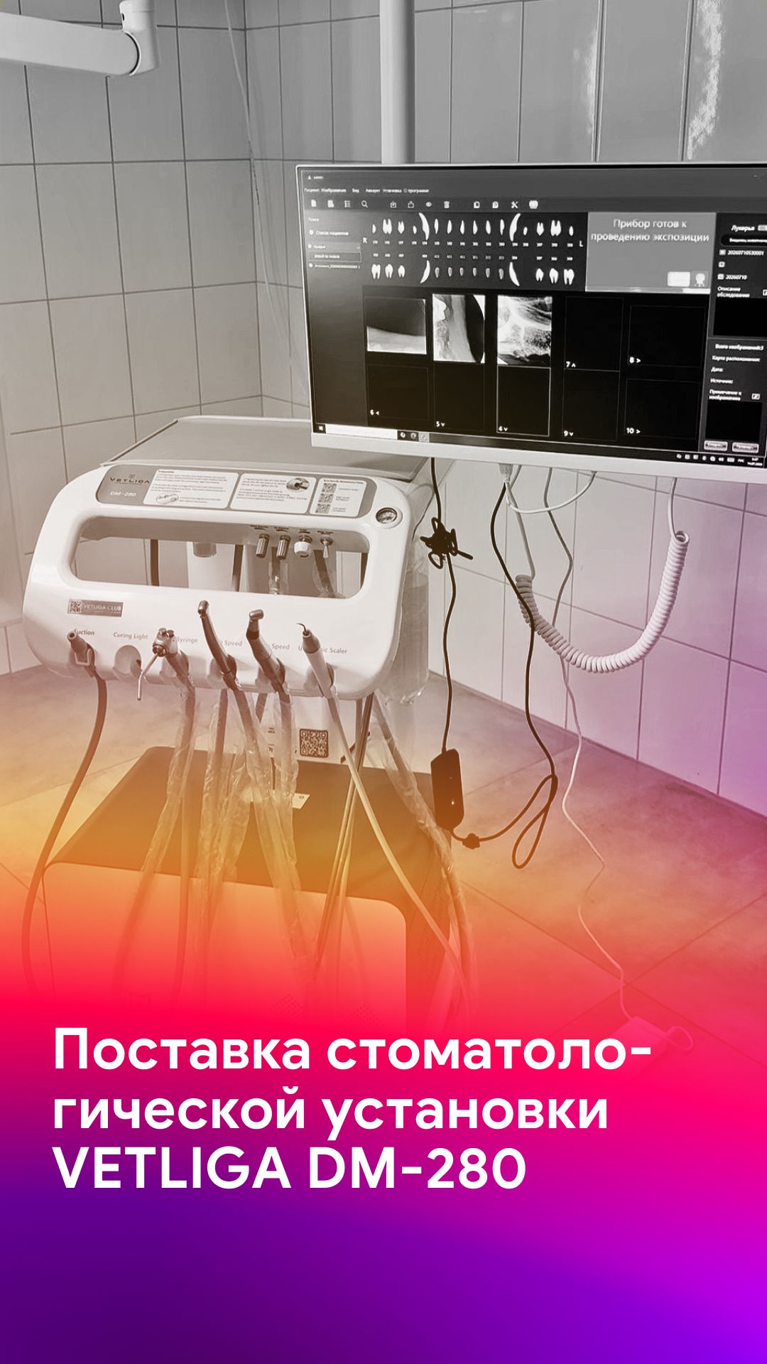 Стоматологическая установка VETLIGA DM-280 - комплексное рабочее место врача