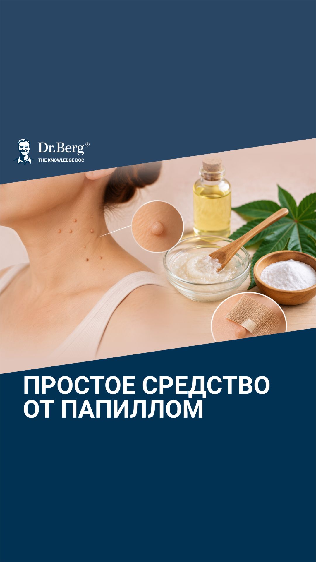 Как избавиться от папиллом БЫСТРО в домашних условиях?