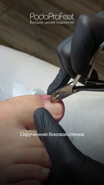 Прием клиента с воспалением и грануляцией