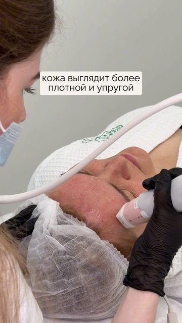 RF-лифтинг Volnewmer в «Бест Клиник»