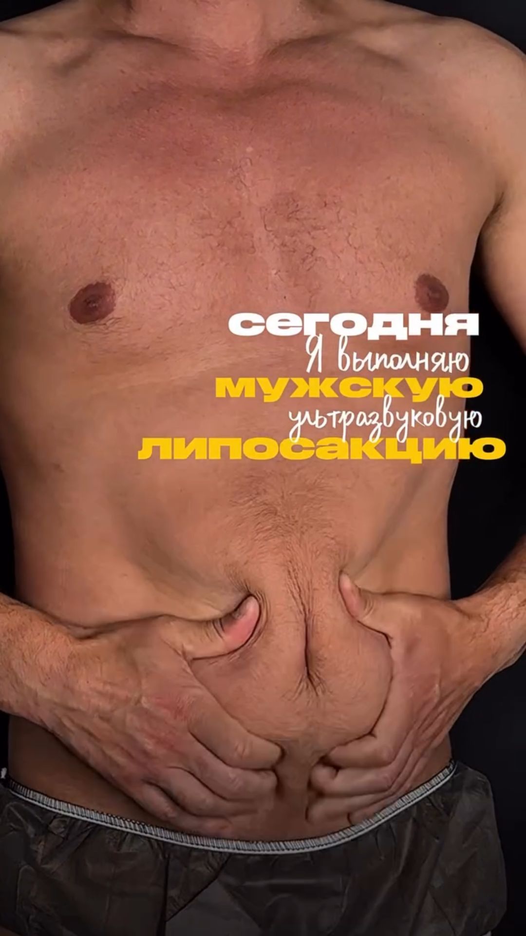 МУЖИКИ ПЛАСТИКА - ЭТО НЕ СТЫДНО! 
