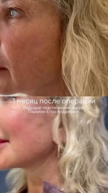 Егор Андреевич Парыгин вернул пациентке свою естественную молодость