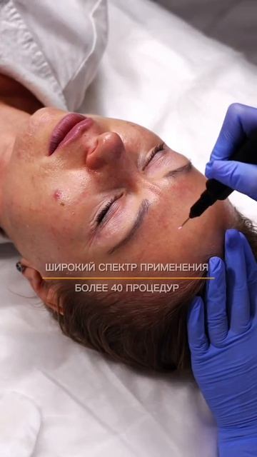 ПОЧЕМУ СПЕЦИАЛИСТЫ ВЫБИРАЮТ PLAZOBEST SUPERAN?