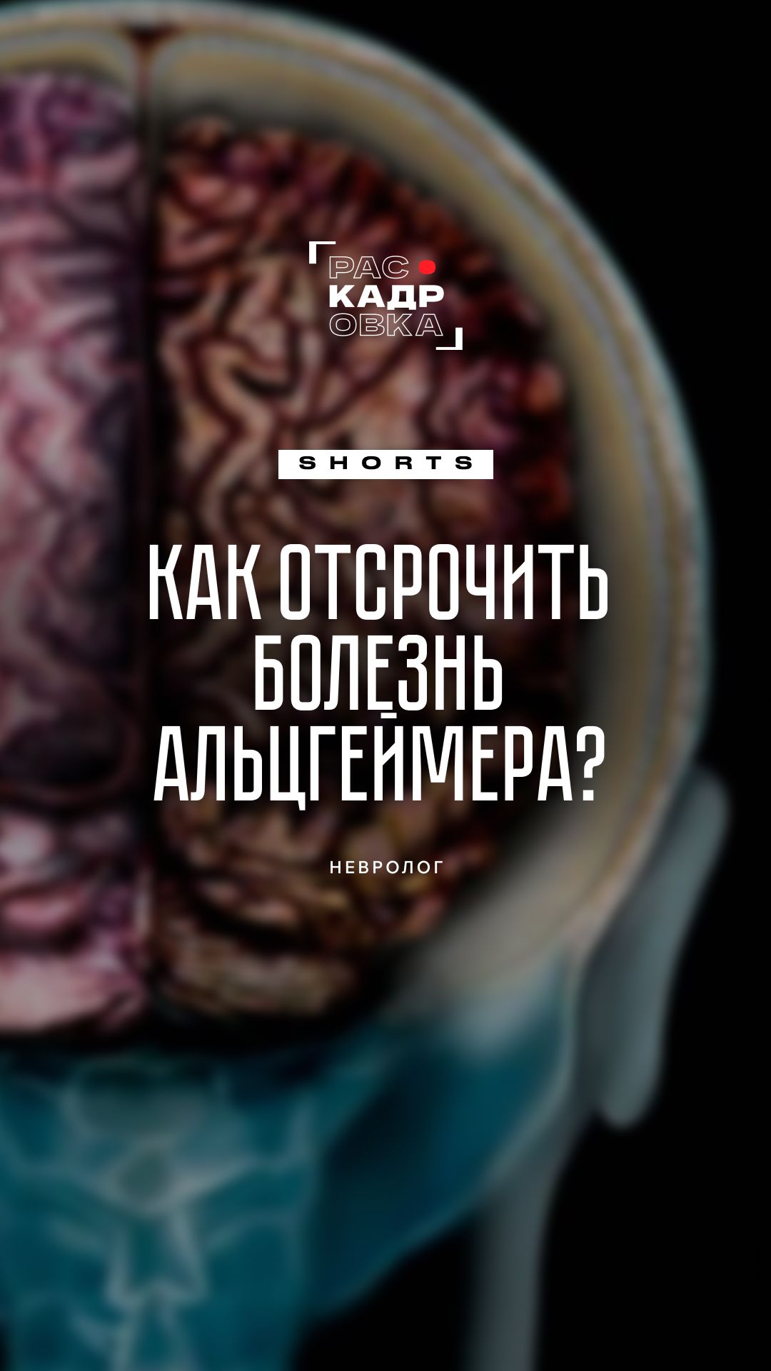 Людям, читающим книги, не страшна болезнь Альцгеймера