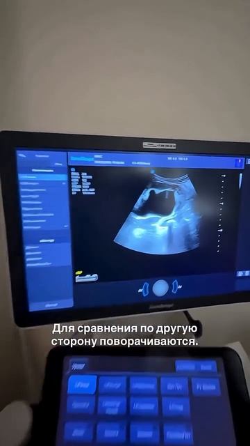 Камень застрял в мочеточнике. Почка не работает.