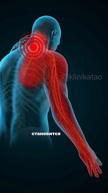 Почему немеют руки и пальцы?