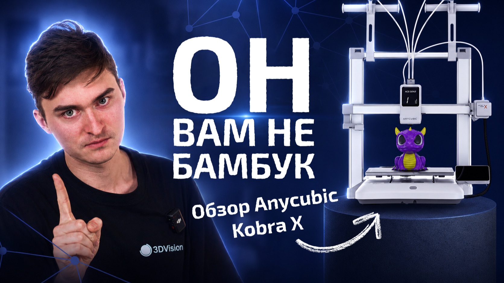Он вам не BambuLab  Обзор Anycubic Kobra X