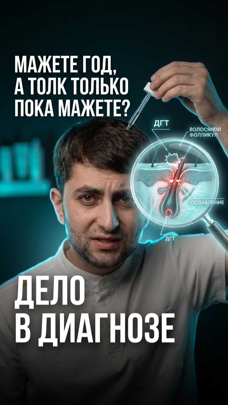 Фабао от выпадения волос — помогает или маскирует андрогенную алопецию? 💧