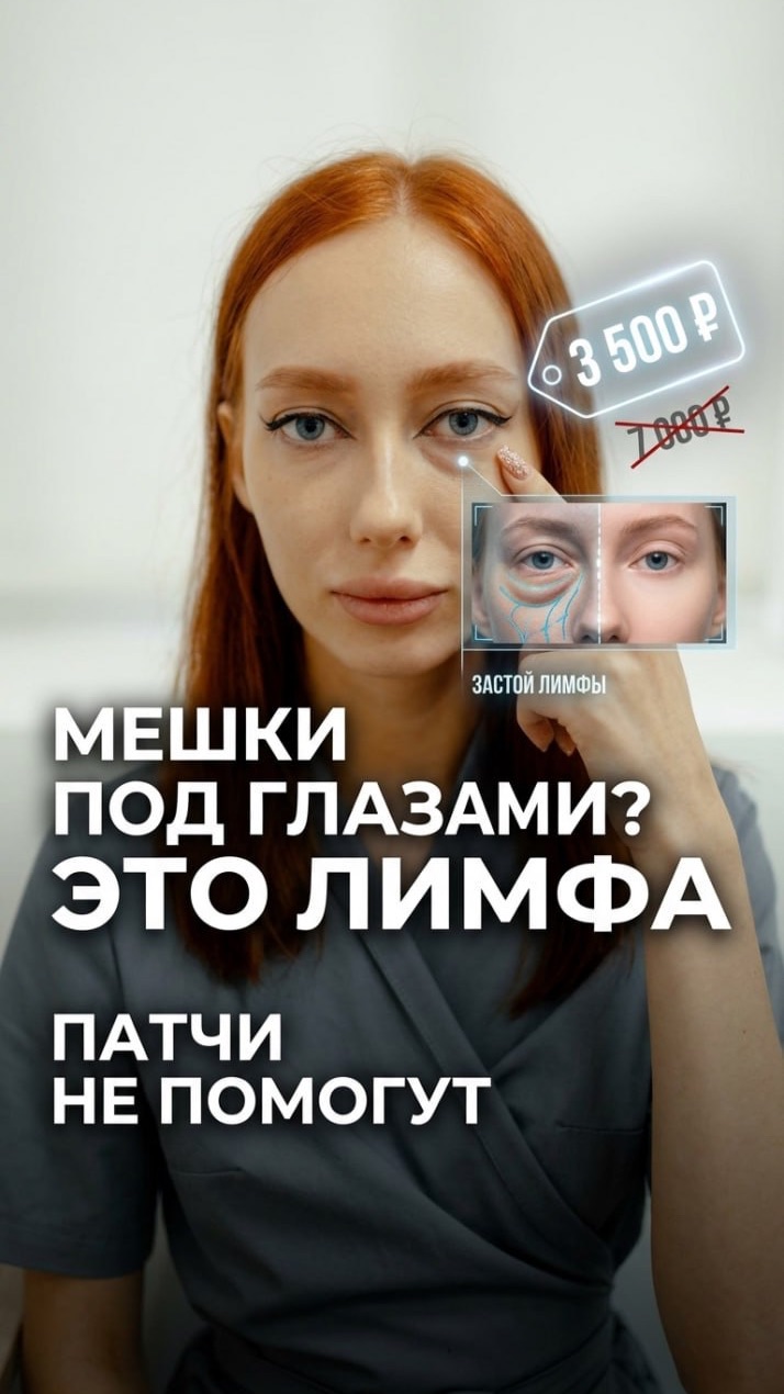 🩺 Мешки под глазами: почему патчи не помогают — объясняет врач-косметолог