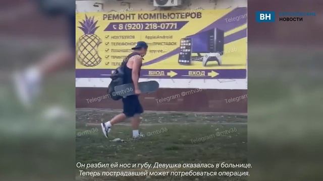 Девушка получила скейтбордом в лицо от мужчины, заступившись за незнакомку в Воронеже