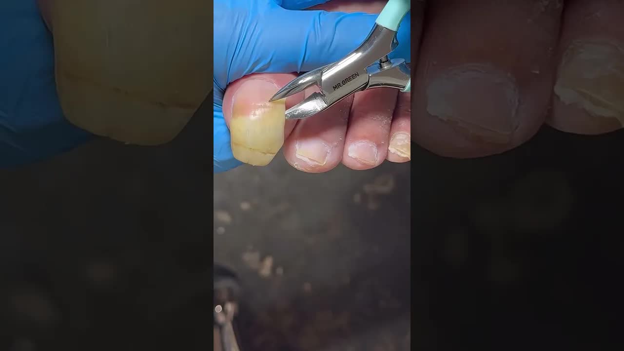 Ногти на ногах желтые и прозрачные  процесс стрижки невероятный! satisfying nails