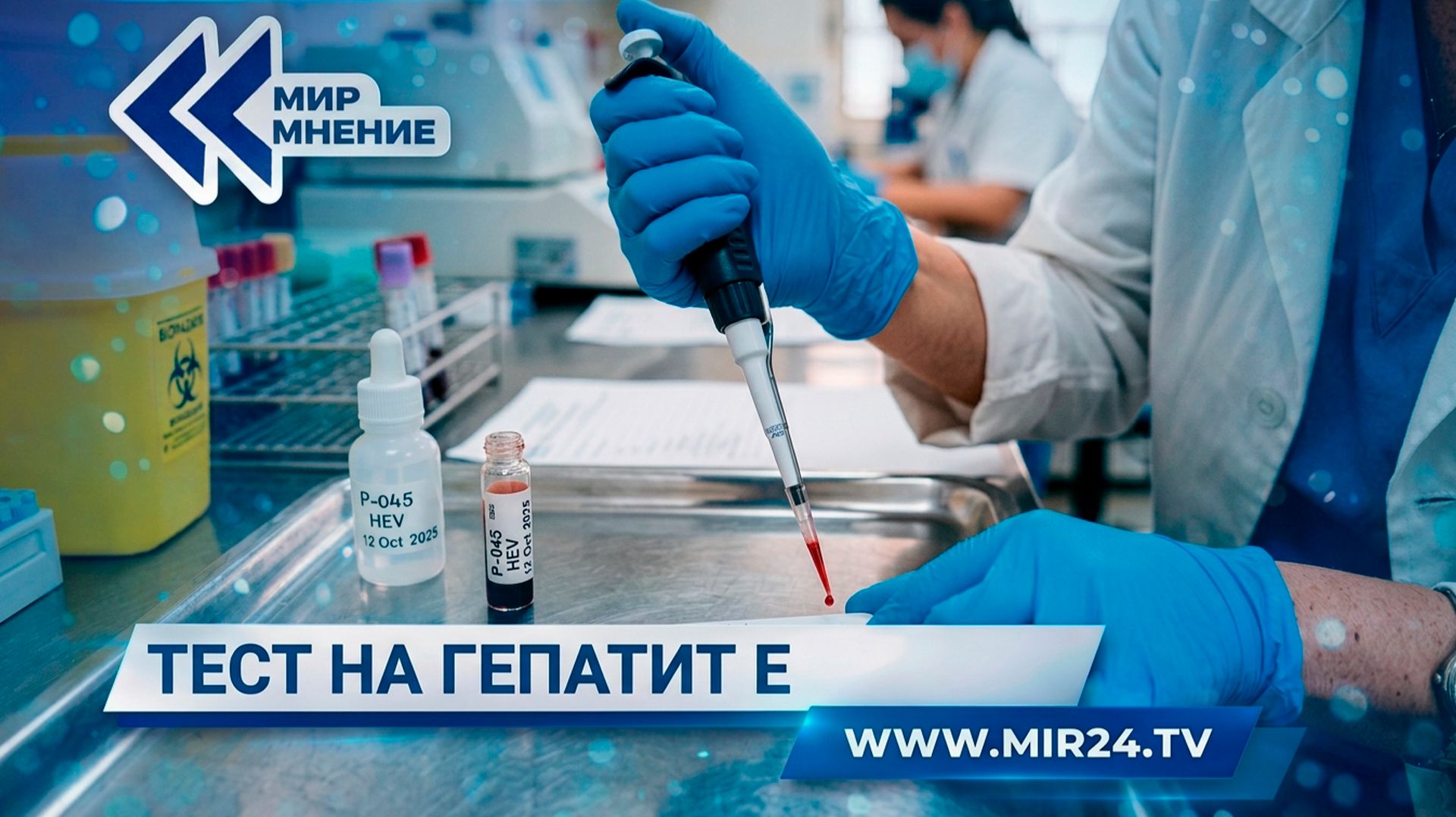 Первый отечественный тест на гепатит E: его возможности и перспективы