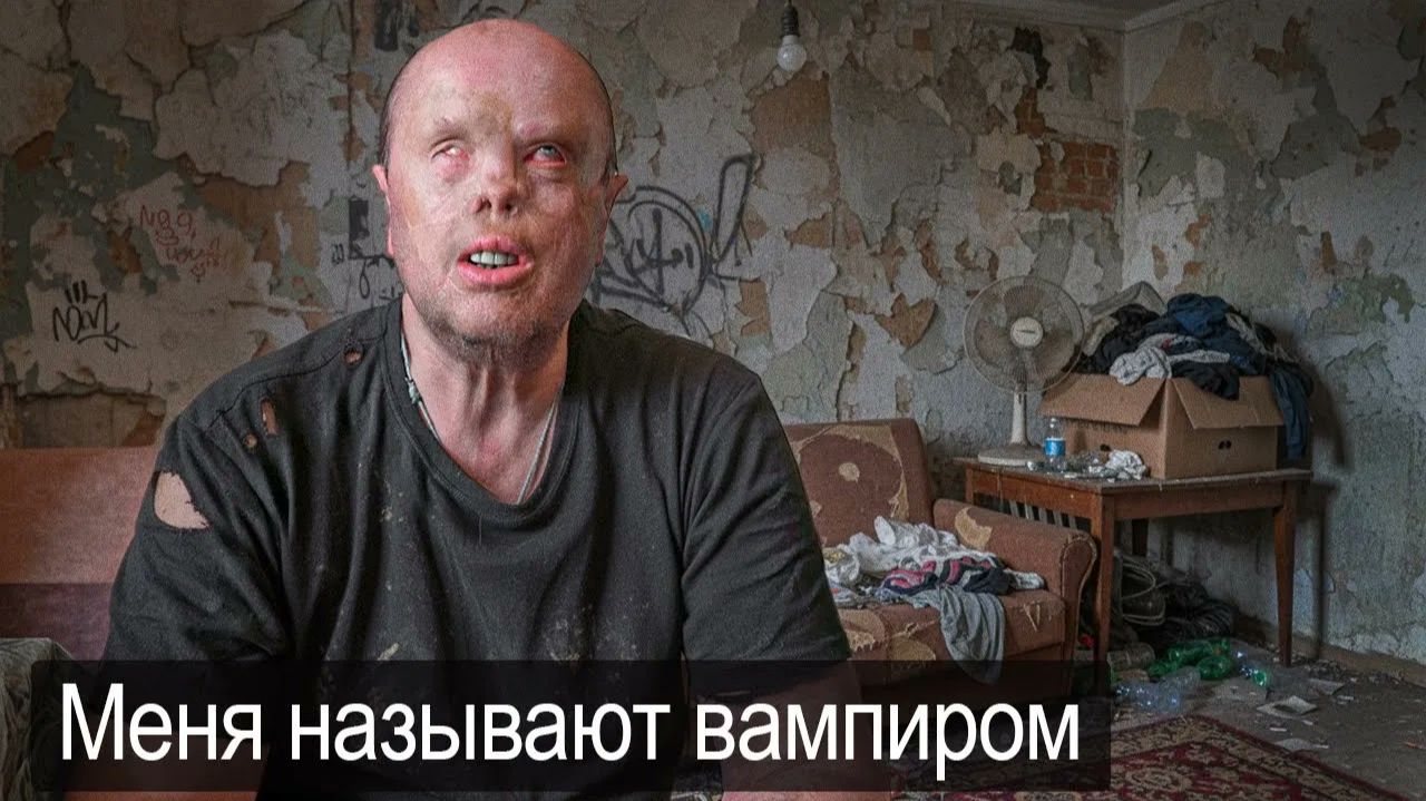 Я ХОЧУ ЖИТЬ КАК ВСЕ НОРМАЛЬНЫЕ ЛЮДИ.
