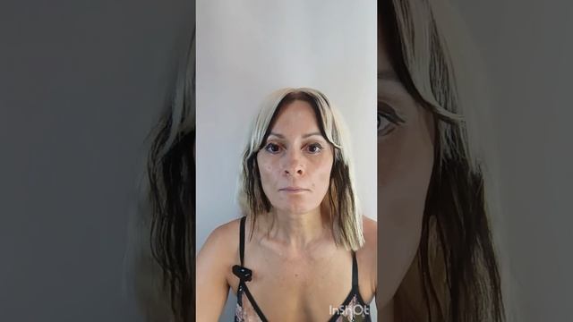 Почему стекают ткани лица. Лифтинг