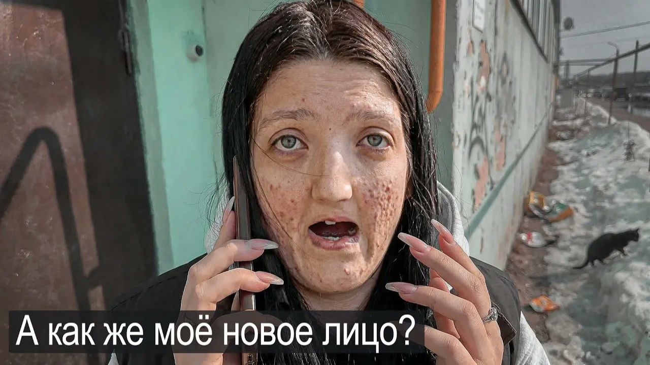 Я ЖДАЛА ДО 18 ЛЕТ ПЛАСТИЧЕСКУЮ ОПЕРАЦИЮ И МЕНЯ ОБМАНУЛИ.
