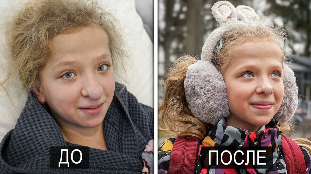 Новый носик-новая жизнь.Но не всё как мы ожидали.