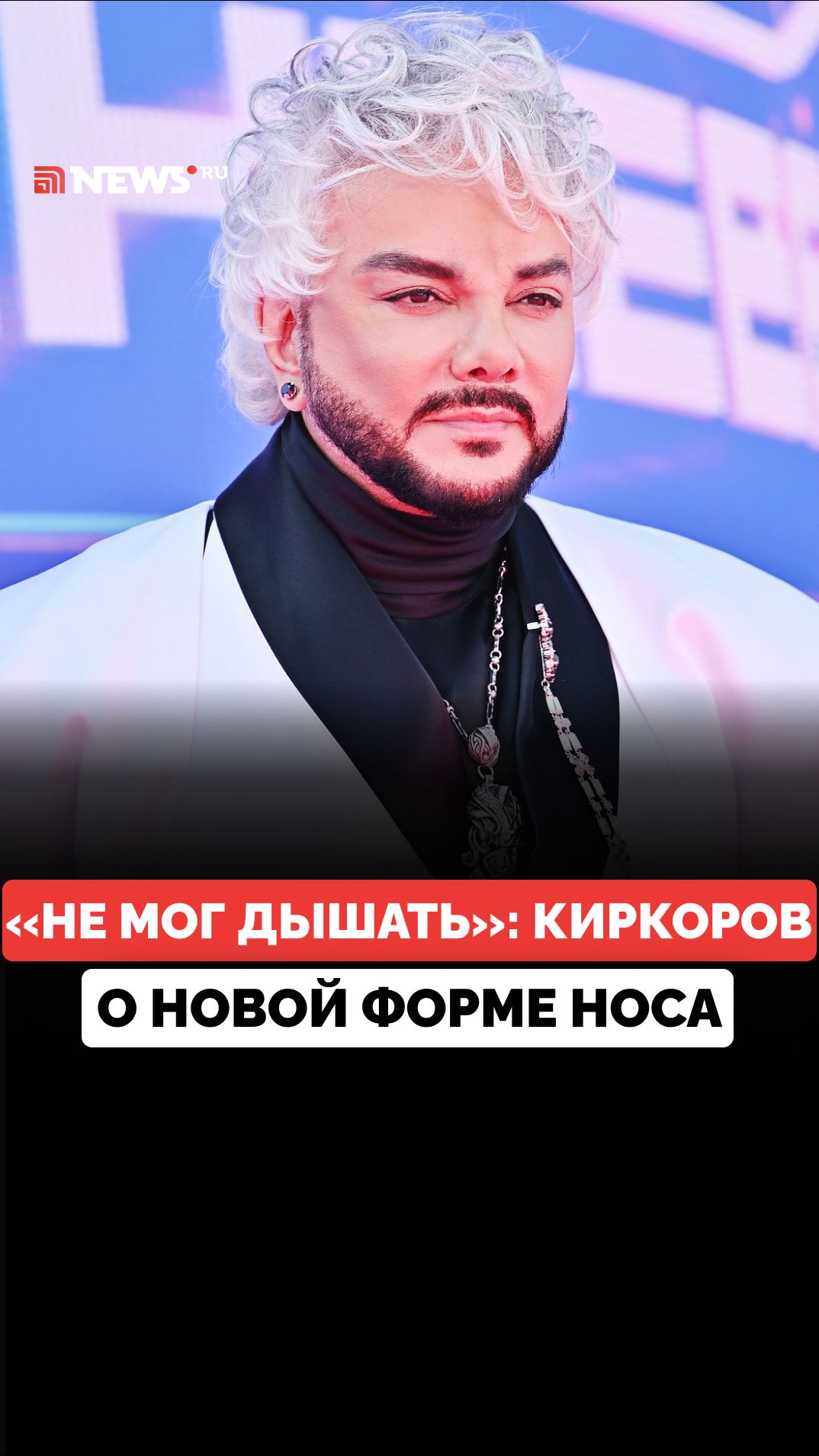 Не может дышать без новых операций. Филипп Киркоров о ринопластике