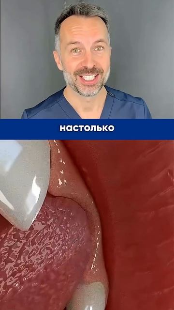 Видео для родителей - молочный зуб