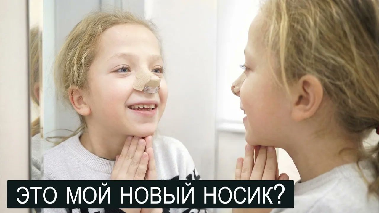 ДЕВОЧКА ПЕРВЫЙ РАЗ УВИДЕЛА СВОЙ НОВЫЙ НОСИК.