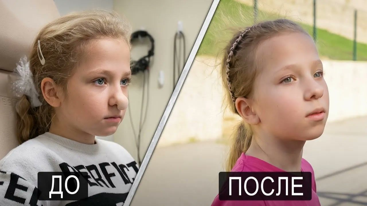 ПОСЛЕ ОПЕРАЦИИ ВАРИ ЕЁ МАМА ПРИЗНАЛА ВИНУ.