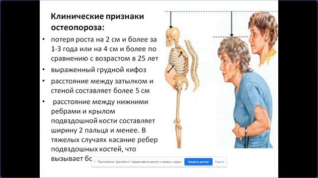 Особенности диспансеризации в возрасте 65 лет и старше