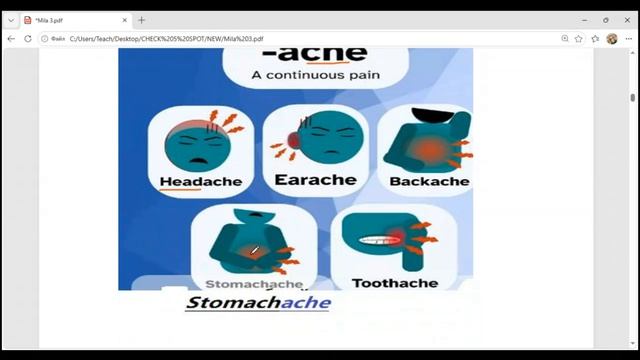 виды боли - Ache