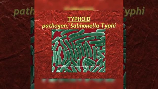 ##THYPOID FEVER ##ANIMATION VIDEO,,,,CAUSED BY SALMONELLA..TYPHI💥💥💥💥💥💥💥💥💥💢💢💢💫💫💫