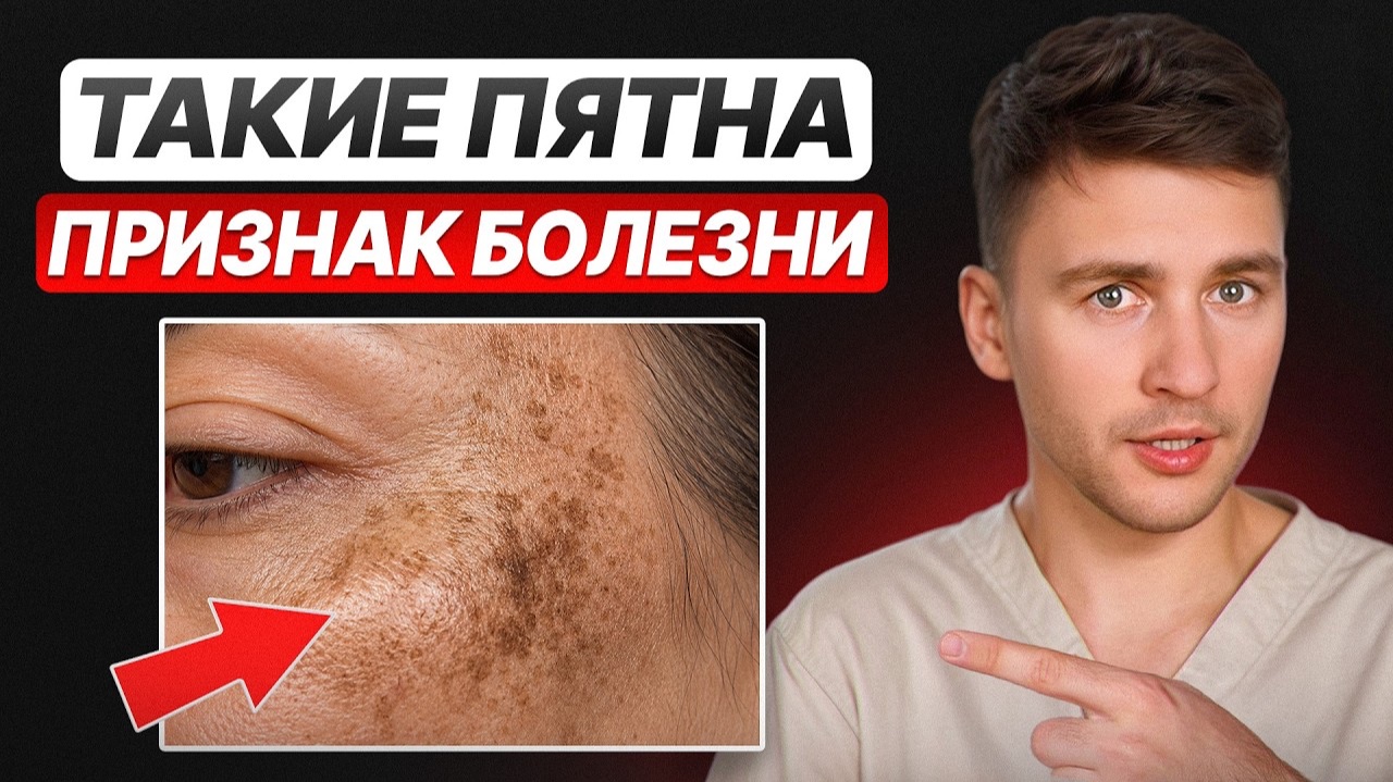 Природа подарила вам индикатор болезней, но 99% людей им НЕ ПОЛЬЗУЮТСЯ! О чем кричат ваше лицо?