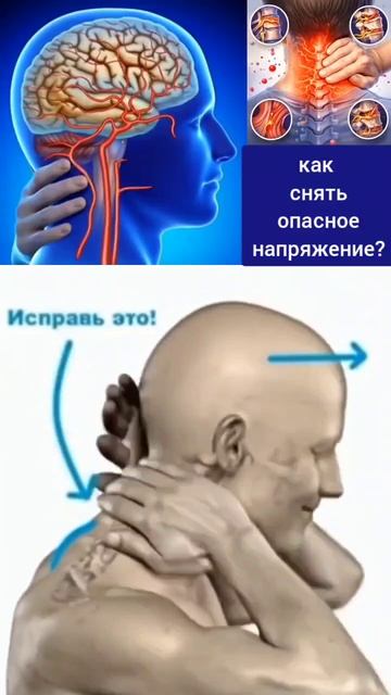 Зажим позвоночных вен - причина деградации мозга и шеи. Методы декомпрессии