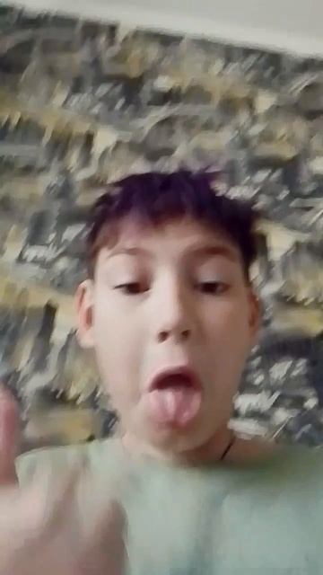 СПАЛИЛ МОЕ ЛИЦО ☠️☠️☠️