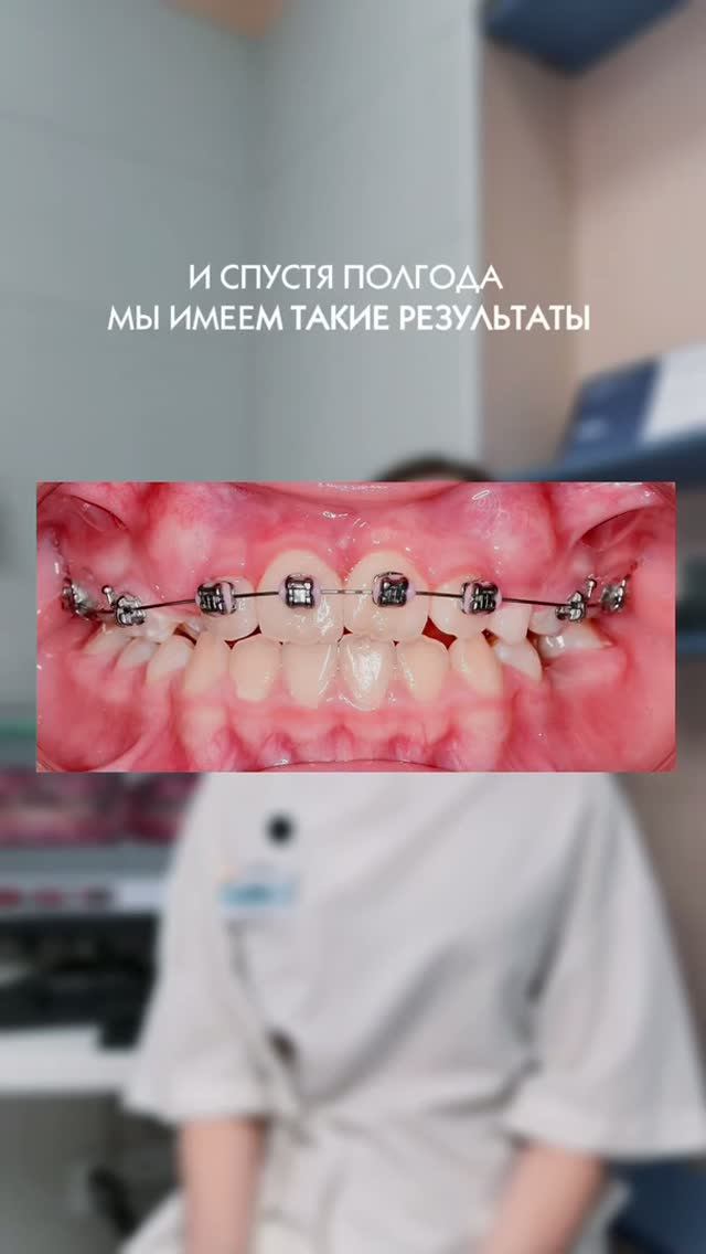Разбираем клинический случай!