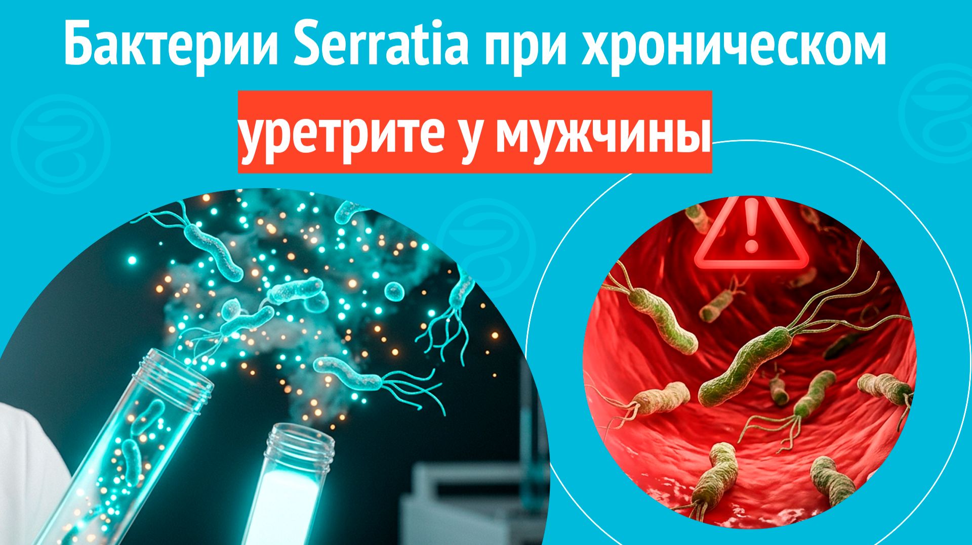 🧫 Бактерии Serratia при хроническом уретрите у мужчины. Клинический случай № 1849