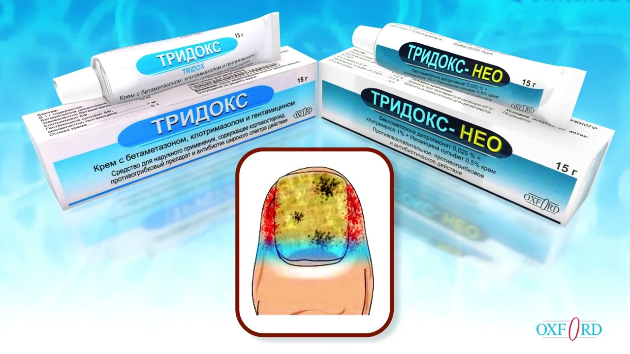 Тридокс Нео полная победа над грибком!