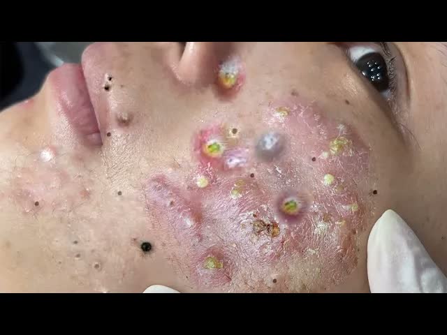 Советы по очищению и уходу за кожей лица