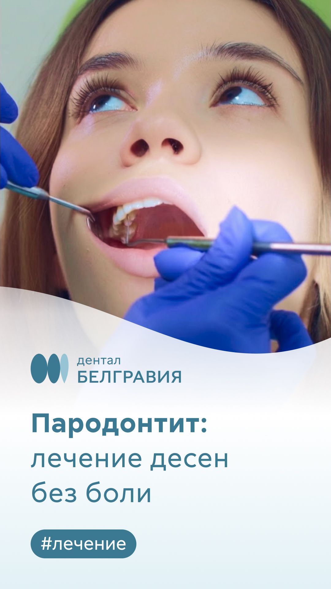 💡 Лечение пародонтита без страха и боли | Дентал Белгравия