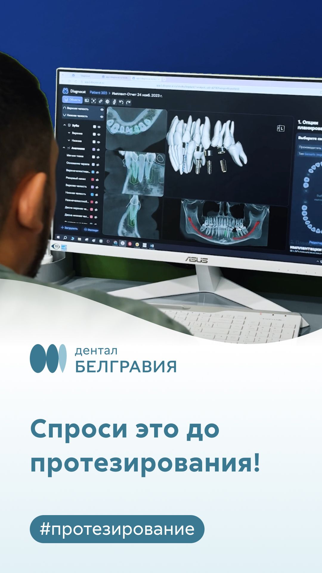 👉 3 главных вопроса перед протезированием зубов 🦷