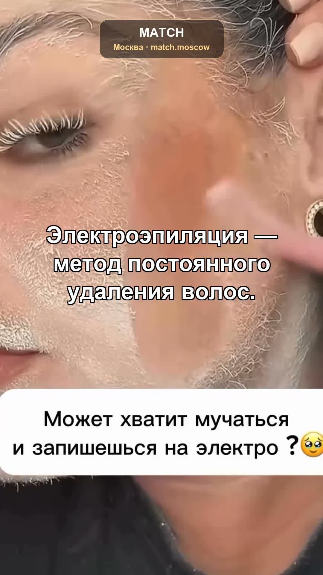 Что такое игловое зонирование при электроэпиляции и почему обрабатывается каждый волосок о