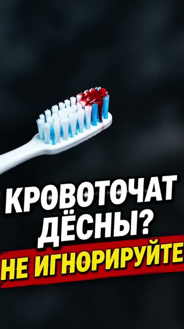 Кровоточат десны? Не игнорируйте!