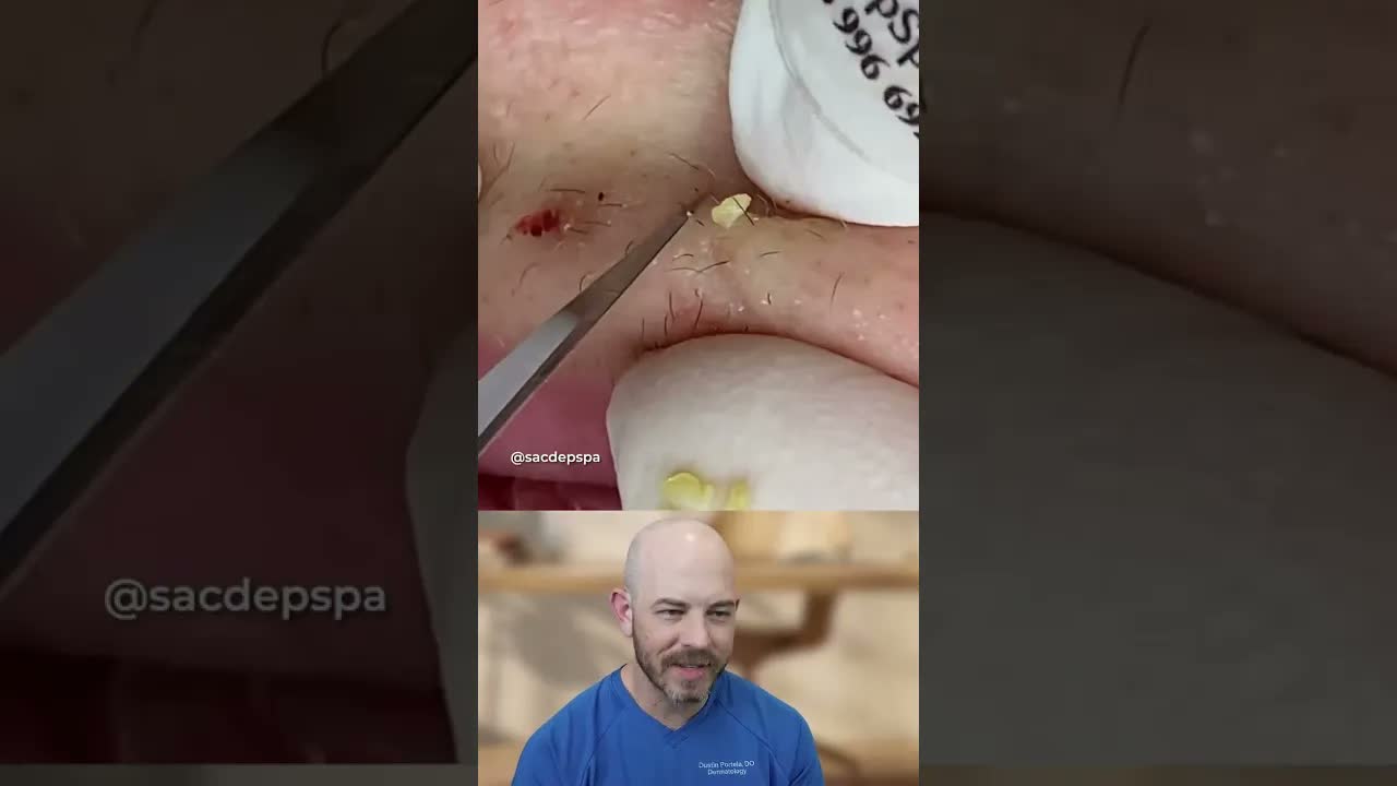 Это извлечение губы впечатлило меня