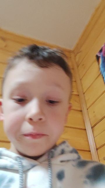я склеил руку