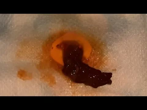 Relax squeezing out blackheads 51 Черные точки