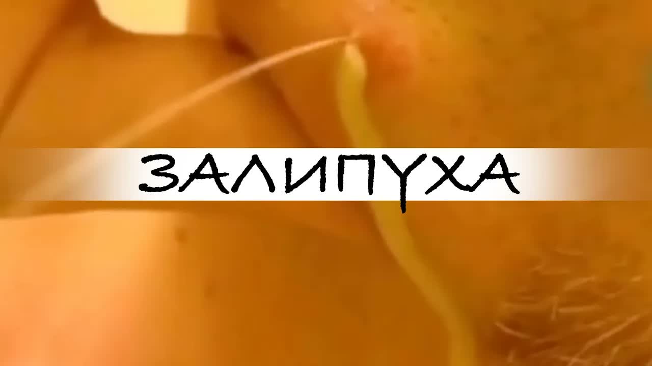 ПРЫЩИ  ПРЫЩИ ВЫДАВЛИВАНИЕ  ПОДБОРКА ВЫДАВЛИВАНИЕ ПРЫЩЕЙ прыщи acne asmr прыщиналице