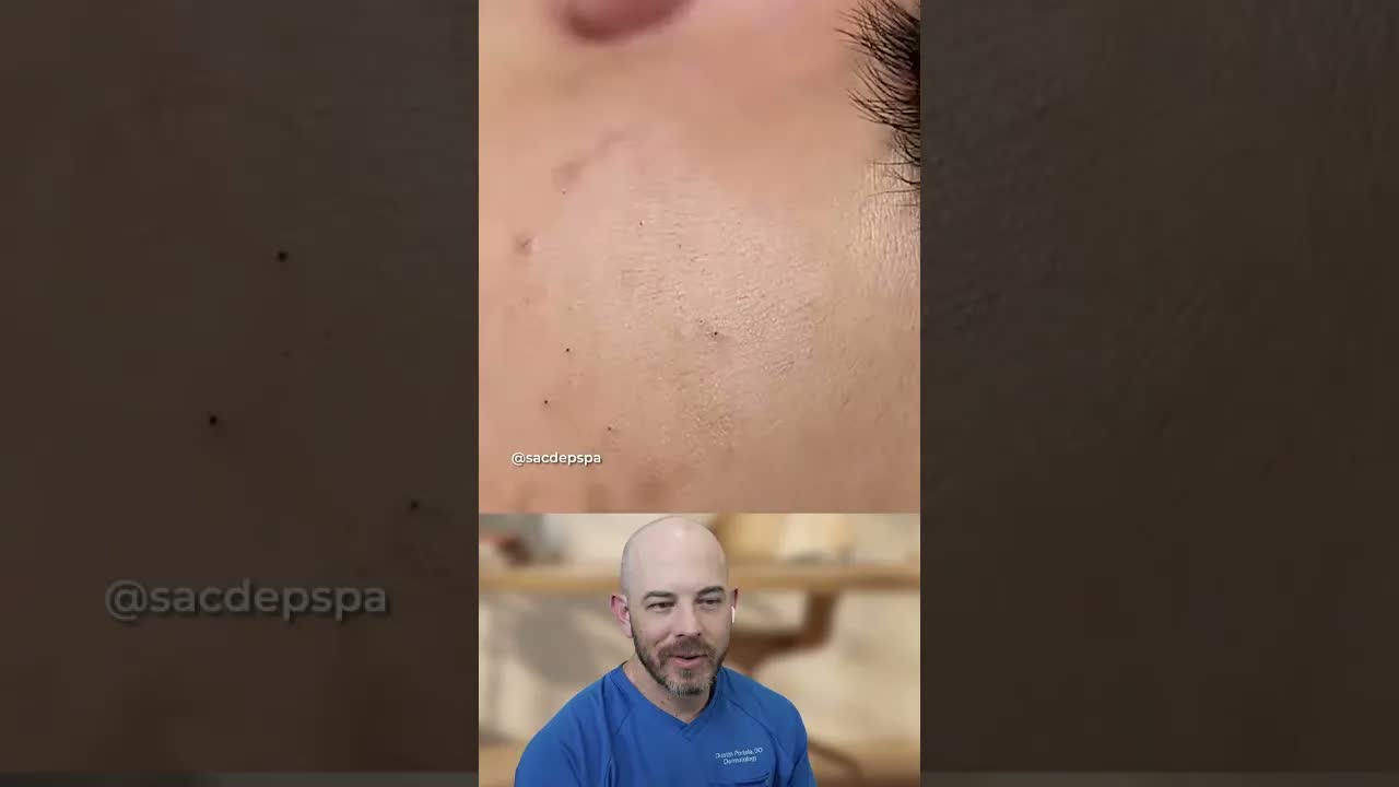Это монобровь?