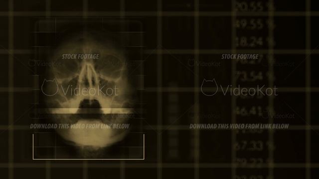 Scan of a human skull looped brown hud interface medical equipment