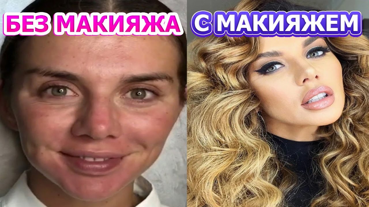 НЕ УПАДИТЕ ОТ УЖАСА! ЗВЕЗДЫ КОТОРЫХ НЕ УЗНАТЬ БЕЗ МАКИЯЖА: ГЛЮКОЗА БУЗОВА СЕДАКОВА ЛОБОДА...