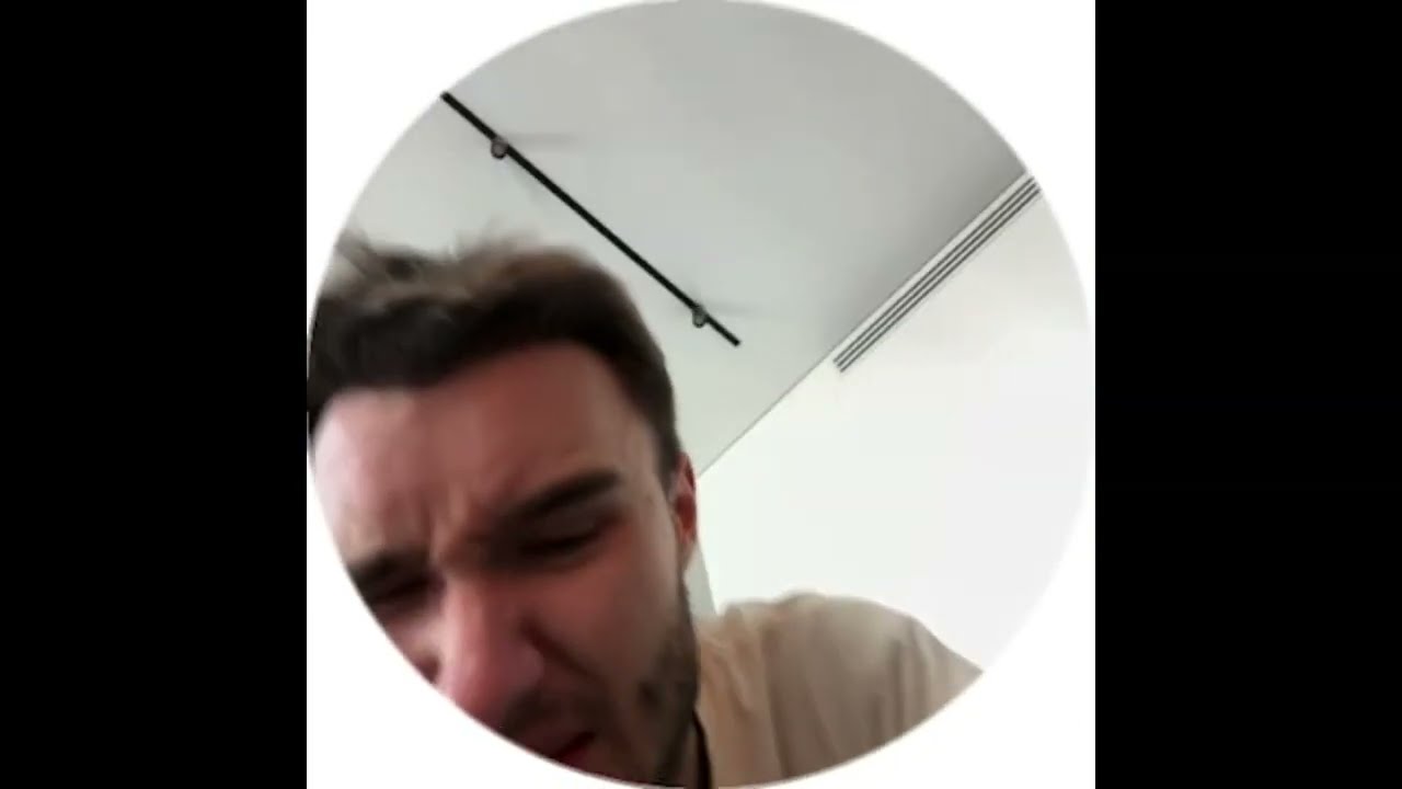 КОРЕШ СЛОМАЛ ПАЛЕЦ