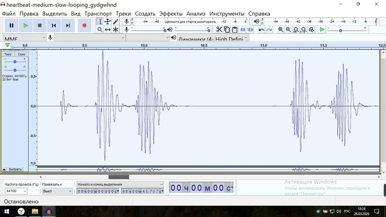 20260326 182224 ПАТТЕРНЫ ЗВУК БИЕНИЯ СЕРДЦА